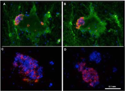 Contributions of Europeans to Xenotransplantation Research: 2. Pig Islet and Cell Xenotransplantation